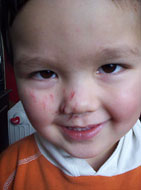 Arme ik